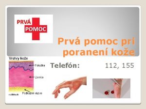 Prv pomoc pri poranen koe Telefn 112 155