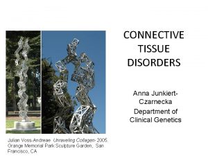 CONNECTIVE TISSUE DISORDERS Anna Junkiert Czarnecka Department of