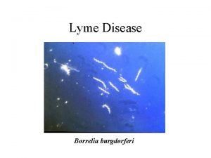 Lyme Disease Borrelia burgdorferi Species Area Curves S