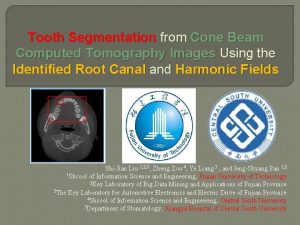 Tooth Segmentation from Cone Beam Computed Tomography Images