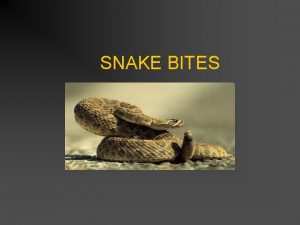 SNAKE BITES OVERVIEW n n Overexaggerated Local Information