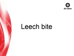 Leech bite Introduction Leeches are Annelids or segmented