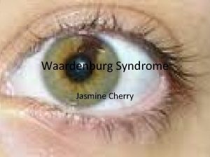 Waardenburg Syndrome Jasmine Cherry What is it Waardenburg