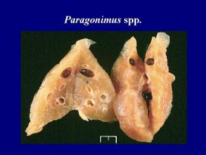 Paragonimus spp Paragonimus westermani Definitive Hosts Paragonimus kellicotti