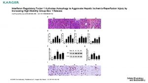 Interferon Regulatory Factor 1 Activates Autophagy to Aggravate