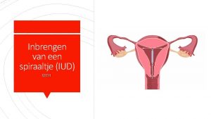 Inbrengen van een spiraaltje IUD MTH Twee soorten