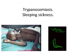 Trypanosomiasis Sleeping sickness African trypanosomiasis Sleeping sickness protozoan