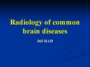 Radiology of common brain diseases 365 RAD 1