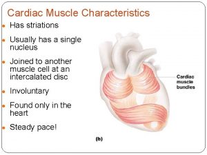 Cardiac Muscle Characteristics Has striations Usually has a