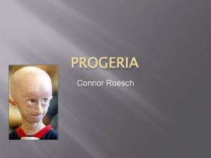 PROGERIA Connor Roesch How does it happen Progeria