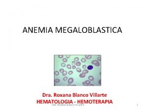 ANEMIA MEGALOBLASTICA Dra Roxana Blanco Villarte HEMATOLOGIA HEMOTERAPIA