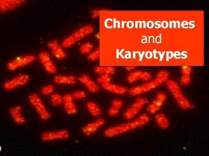 Chromosomes and Karyotypes Karyotypes n A picture of
