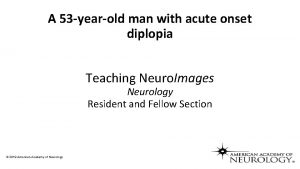 A 53 yearold man with acute onset diplopia