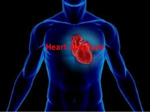 Heart Structure Function of a heart What is