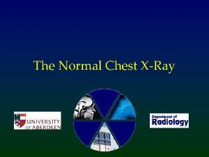 The Normal Chest XRay Introduction Most of the