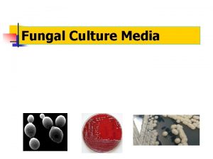 Fungal Culture Media Fungal Culture n Tubed media