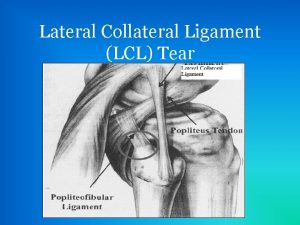 Lateral Collateral Ligament LCL Tear Development of LCL