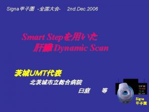 Dynamic Scan 3 D Fast TOF SPGR MultiPhase