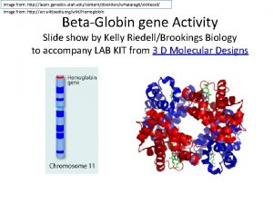 Image from http learn genetics utah educontentdisorderswhataregdsicklecell Image