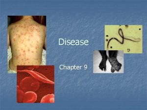 Disease Chapter 9 Disease Defense and Human Health