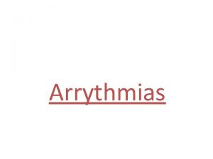 Arrythmias Note Sinus rhythm rate 80min PR interval