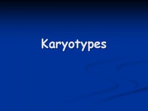 Karyotypes Human Chromosomes n n n Karyotype a