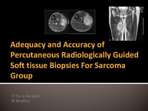 Adequacy and Accuracy of Percutaneous Radiologically Guided Soft