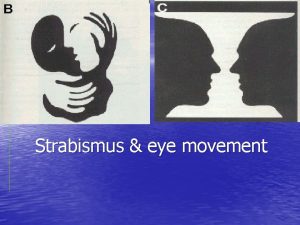 Strabismus eye movement Anatomy The 6 EOM Nerve