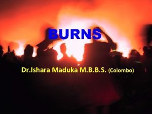 BURNS Dr Ishara Maduka M B B S