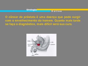 Urologia Online O cncer de prstata uma doena