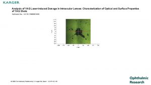 Analysis of YAG LaserInduced Damage in Intraocular Lenses