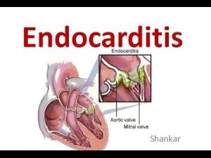 Shankar Endocarditis Endocarditis is inflammation of hearts inner