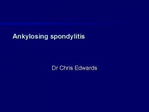 Ankylosing spondylitis Dr Chris Edwards Prevalence Worldwide prevalence