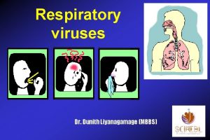 Respiratory viruses Dr Dunith Liyanagamage MBBS 1 Categories