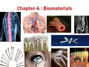 Chapter6 Biomaterials Introduction The materials which are used