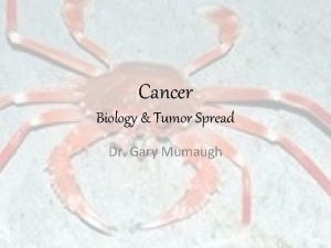 Cancer Biology Tumor Spread Dr Gary Mumaugh Even