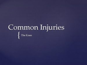 Common Injuries The Knee Patellar Fractures MOI Rapid