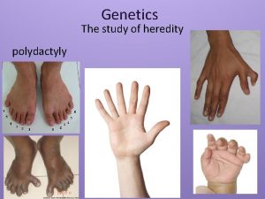 Genetics The study of heredity polydactyly Heredity The