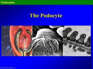 Podocytes Podocytes the filtration barrier an amazing structure