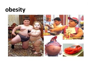 obesity OBJECTIVES Definition BMI Causes of overweight in