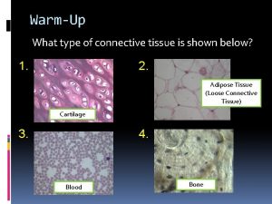 WarmUp What type of connective tissue is shown