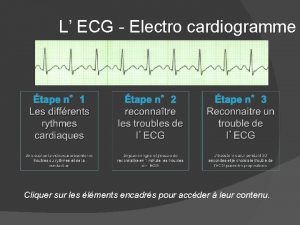 L ECG Electro cardiogramme Cliquer sur les lments