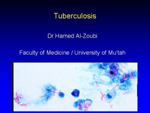 Tuberculosis Dr Hamed AlZoubi Faculty of Medicine University
