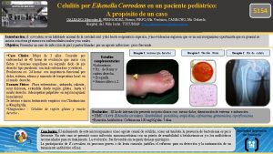 Celulitis por Eikenella Corrodens en un paciente peditrico
