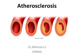 Atherosclerosis Dr Abhirami S MBBS Atherosclerosis Atherosclerosis is