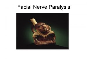 Facial Nerve Paralysis Examination of the mouth and