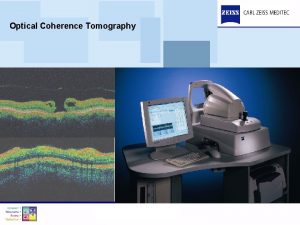 Optical Coherence Tomography What is Optical Coherence Tomography