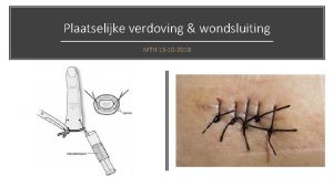 Plaatselijke verdoving wondsluiting MTH 13 10 2019 Plaatselijke