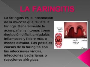LA FARINGITIS La faringitis es la inflamacin de