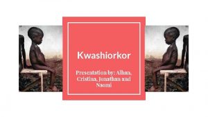 Kwashiorkor Presentation by Alhan Cristina Jonathan and Naomi